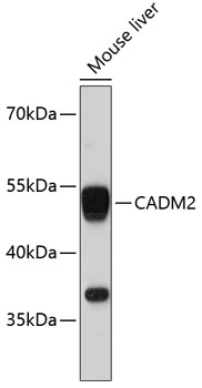 CADM2 Rabbit pAb