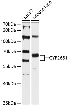 CYP26B1 Rabbit pAb
