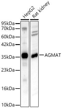 AGMAT Rabbit pAb