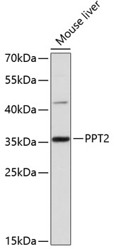 PPT2 Rabbit pAb