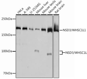 NSD3/WHSC1L1 Rabbit mAb