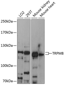 TRPM8 Rabbit pAb