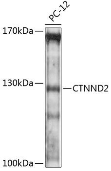 CTNND2 Rabbit pAb