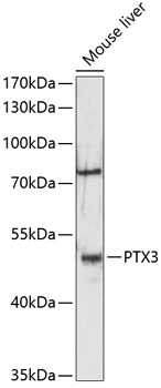 PTX3 Rabbit pAb