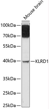 KLRD1 Rabbit pAb
