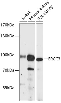 ERCC3 Rabbit pAb