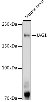 JAG1 Rabbit pAb