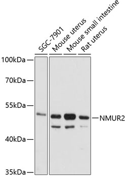 NMUR2 Rabbit pAb