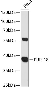 PRPF18 Rabbit pAb