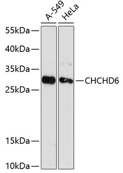 CHCHD6 Rabbit pAb