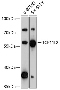 TCP11L2 Rabbit pAb