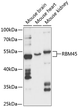 RBM45 Rabbit pAb