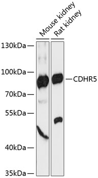 CDHR5 Rabbit pAb