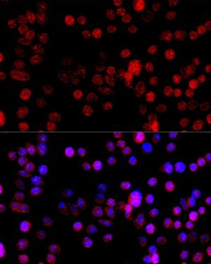 CYP1B1 Rabbit pAb