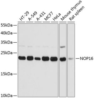 NOP16 Rabbit pAb