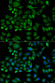 Haptoglobin (HP) Rabbit pAb
