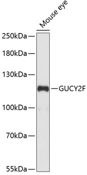 GUCY2F Rabbit pAb