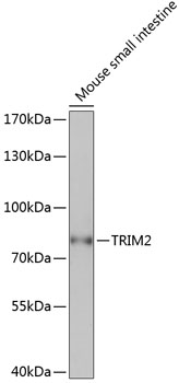 TRIM2 Rabbit pAb