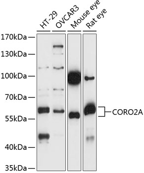 CORO2A Rabbit pAb