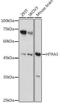 HTRA3 Rabbit pAb