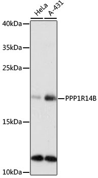 PPP1R14B Rabbit pAb