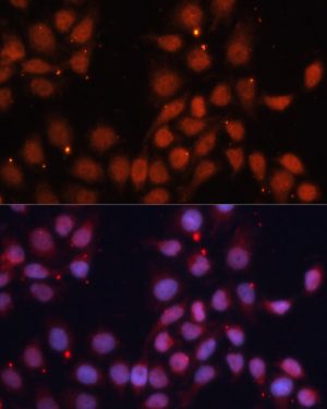CDK11B Rabbit pAb
