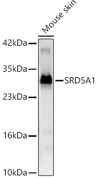 SRD5A1 Rabbit pAb