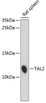 TAL2 Rabbit pAb