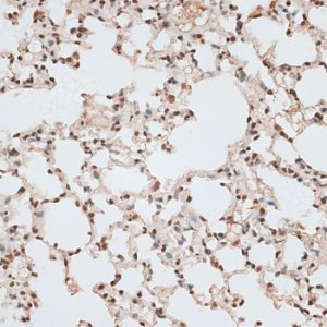 ZNF141 Rabbit pAb