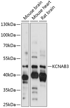 KCNAB3 Rabbit pAb