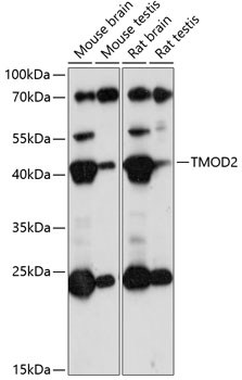 TMOD2 Rabbit pAb