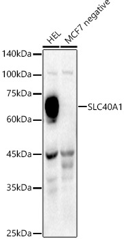 SLC40A1 Rabbit pAb
