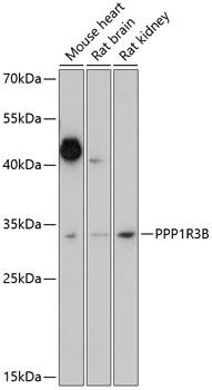 PPP1R3B Rabbit pAb