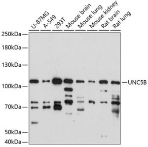 UNC5B Rabbit pAb
