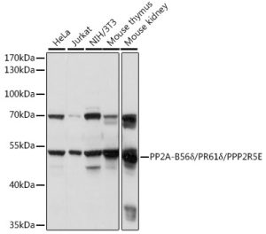 PP2A-B56δ/PR61δ/PPP2R5E Rabbit pAb