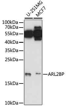 ARL2BP Rabbit pAb