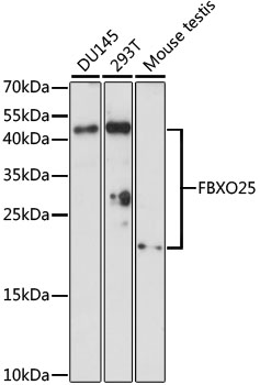 FBXO25 Rabbit pAb