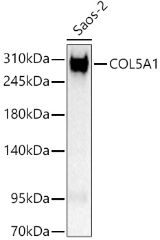 COL5A1 Rabbit pAb