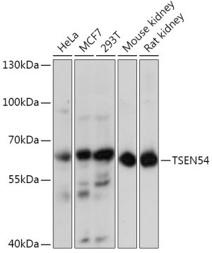 TSEN54 Rabbit pAb