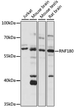 RNF180 Rabbit pAb