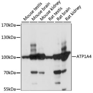 ATP1A4 Rabbit pAb