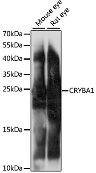 CRYBA1 Rabbit pAb