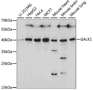 GALK1 Rabbit pAb