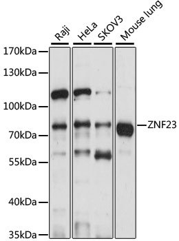 ZNF23 Rabbit pAb
