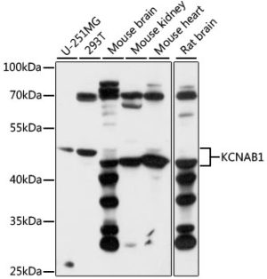 KCNAB1 Rabbit pAb