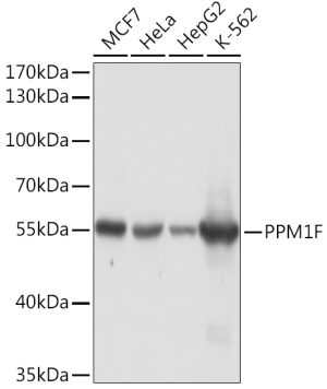 PPM1F Rabbit pAb
