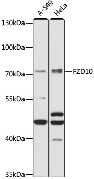 FZD10 Rabbit pAb