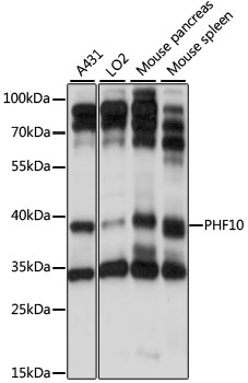 PHF10 Rabbit pAb