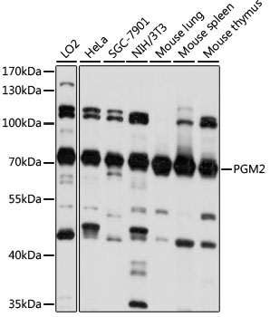PGM2 Rabbit pAb