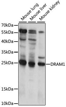 DRAM1 Rabbit pAb